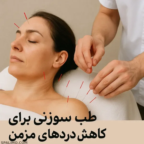 طب سوزنی برای کاهش دردهای مزمن